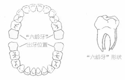 六齡齒是哪顆牙圖片展示教你怎麼判斷是不是六齡齒